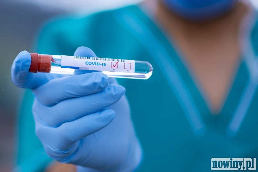 Sytuacja epidemiologiczna w Rybniku. Mniej zakażonych, nie ma zgonów, są ozdrowieńcy